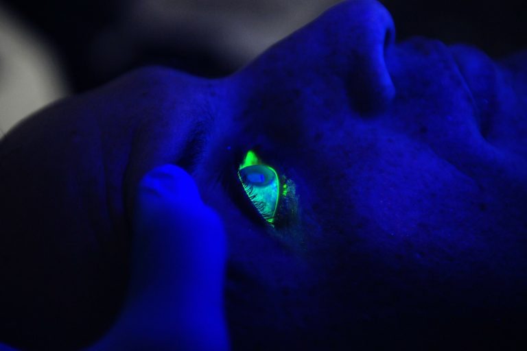 Laser oeil