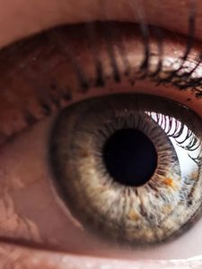 DMLA atrophique et “assimilés” : le Stargardt