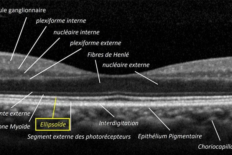 Etudes de l'ellipsoïde