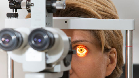 La cilio rétinienne