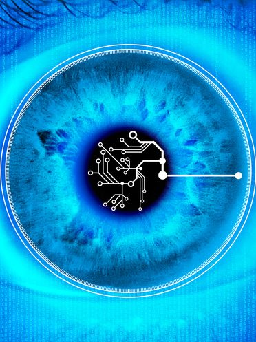 OCT et pronostic visuel dans l’OMD