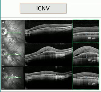 Scan diagnostic iCNV